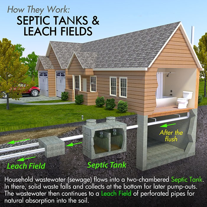 septic001
